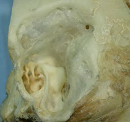 What structures are in the temporal bone?