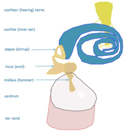 Artwork Of Prosthetic Stapes In Middle Ear Photograph by John